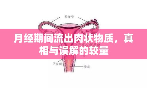 月經(jīng)期間流出肉狀物質(zhì)，真相與誤解的較量