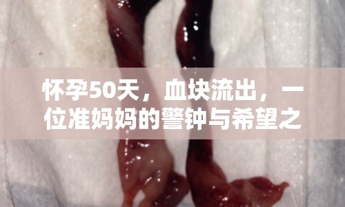 懷孕50天，血塊流出，一位準媽媽的警鐘與希望之旅