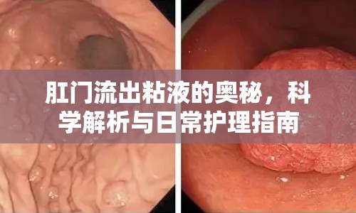 肛門(mén)流出粘液的奧秘，科學(xué)解析與日常護(hù)理指南