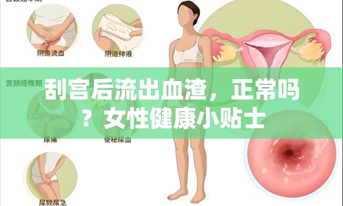 刮宮后流出血渣，正常嗎？女性健康小貼士