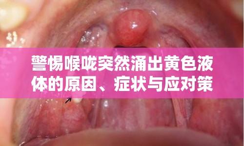 警惕喉嚨突然涌出黃色液體的原因、癥狀與應(yīng)對策略