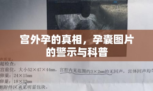 宮外孕的真相，孕囊圖片的警示與科普