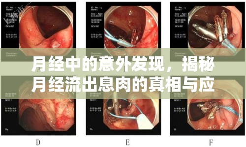 月經(jīng)中的意外發(fā)現(xiàn)，揭秘月經(jīng)流出息肉的真相與應(yīng)對策略