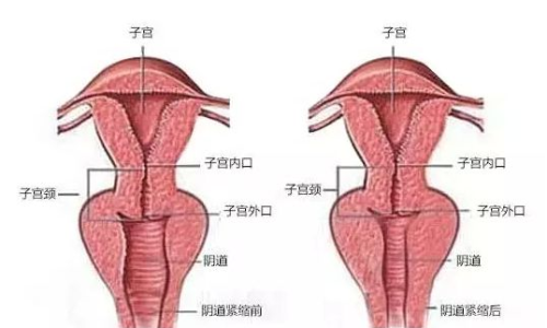 陰道流出血，了解癥狀，關(guān)注健康